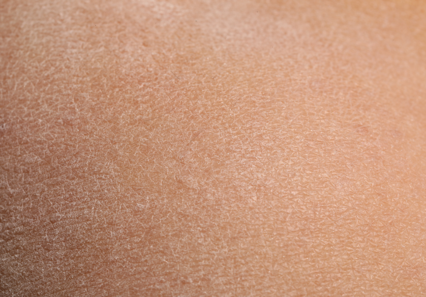 Peau vs hiver : le miel nous protège